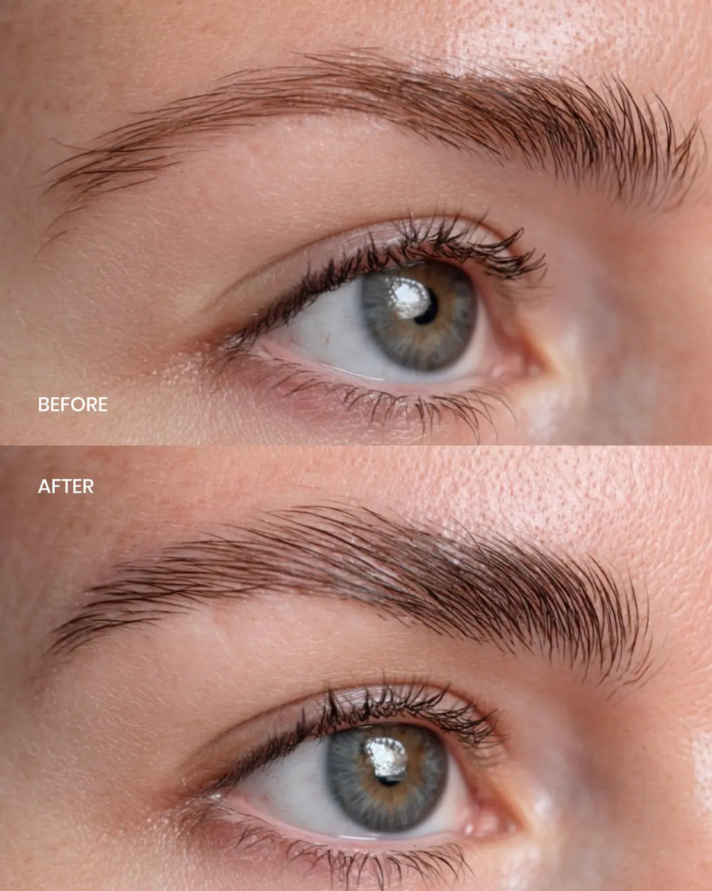 Lenoites® Eyebrow Renewing Serum