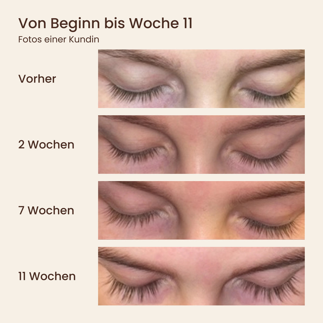 Ergebnisse einer Kundin – vorher, nach 2, 7 und 11 Wochen