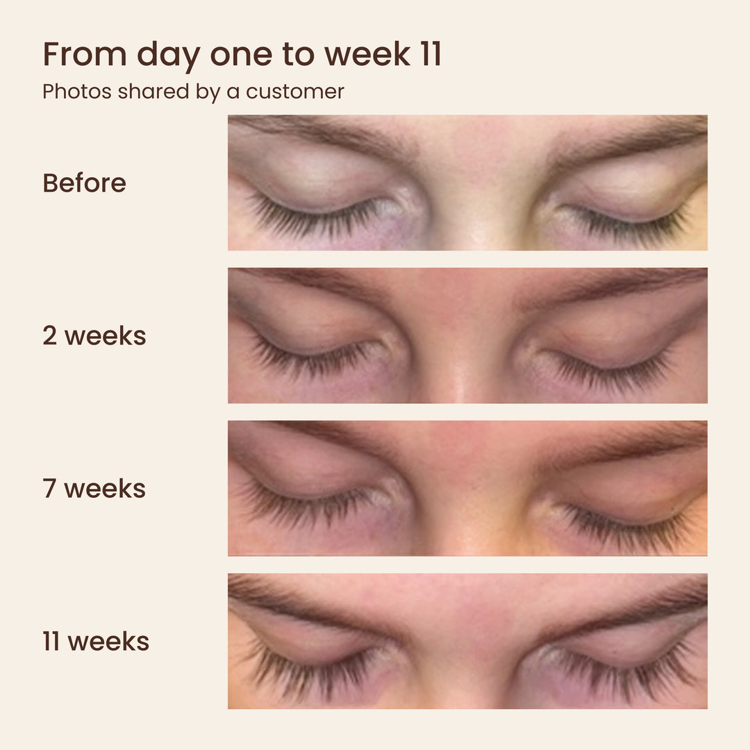 Customer results – before, at 2, 7 and 11 weeks