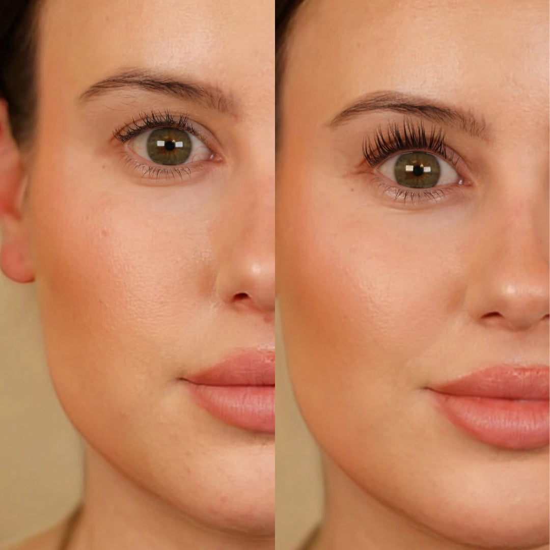 Angelina – Before / After