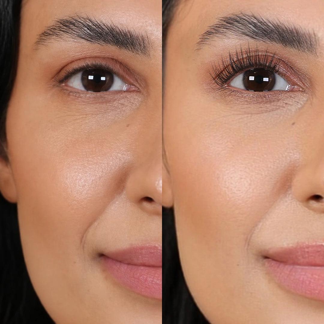 Nora – Before / After